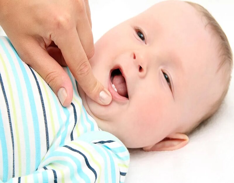 Bé chậm mọc răng là dấu hiệu muộn dễ thấy nhất của thiếu vitamin D