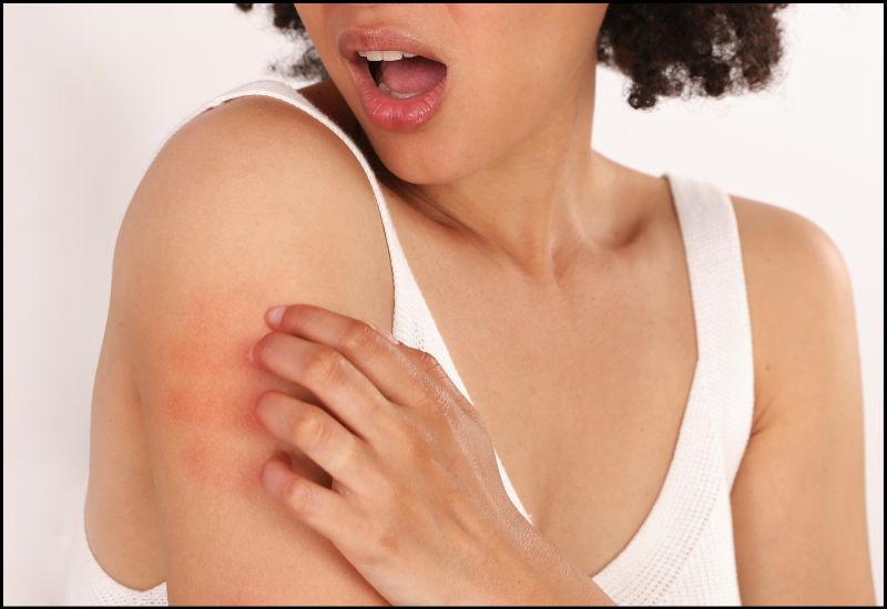 Khi thấy da bị kích ứng cần ngưng sử dụng sản phẩm dầu mù u ngay