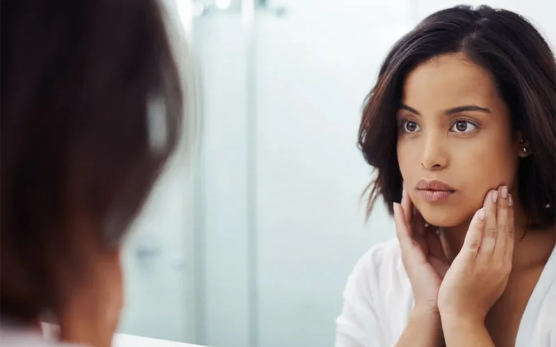 Thay đổi nội tiết tố có thể gây mụn cho mẹ bầu